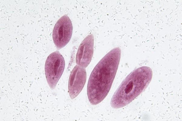 Bipartición: qué es, etapas y tipos - Ejemplos de bipartición