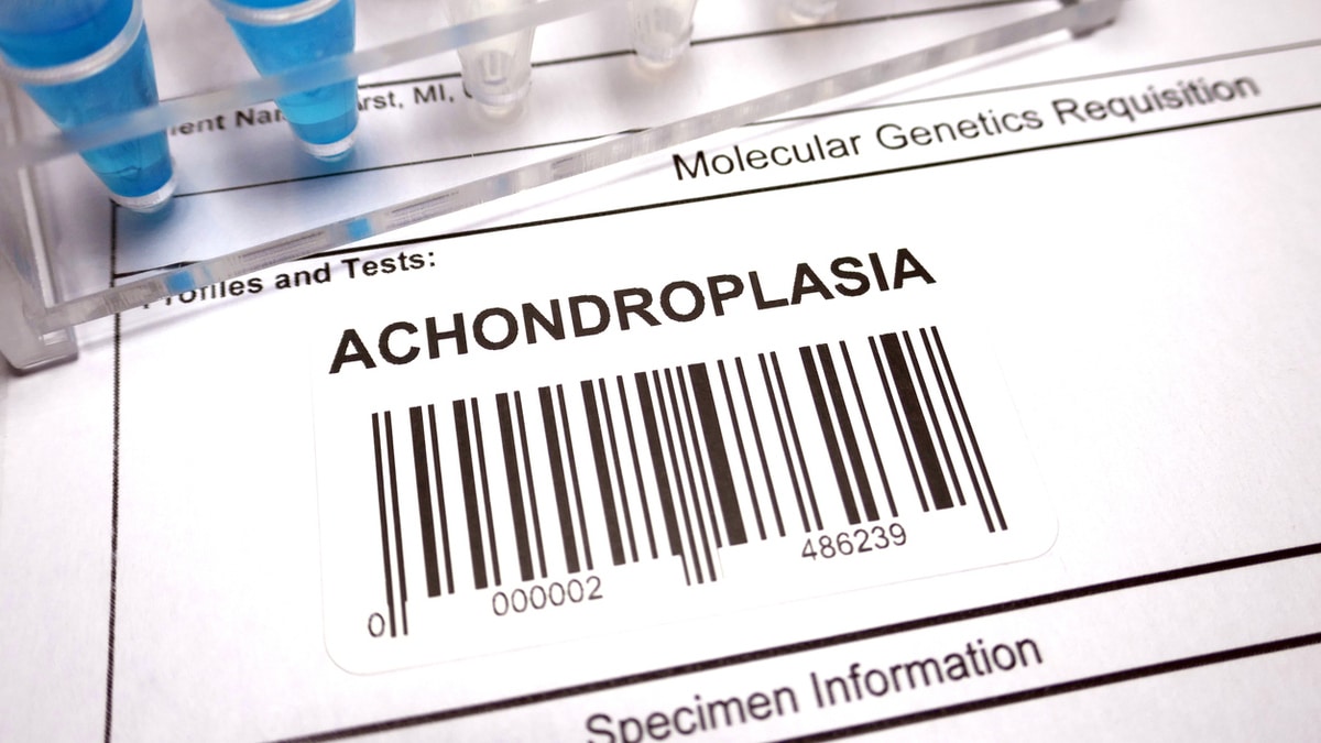 Achondroplasie : caractéristiques, diagnostic et traitements